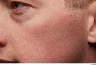 HD Face Skin Sam Atkins cheek eye face skin pores…